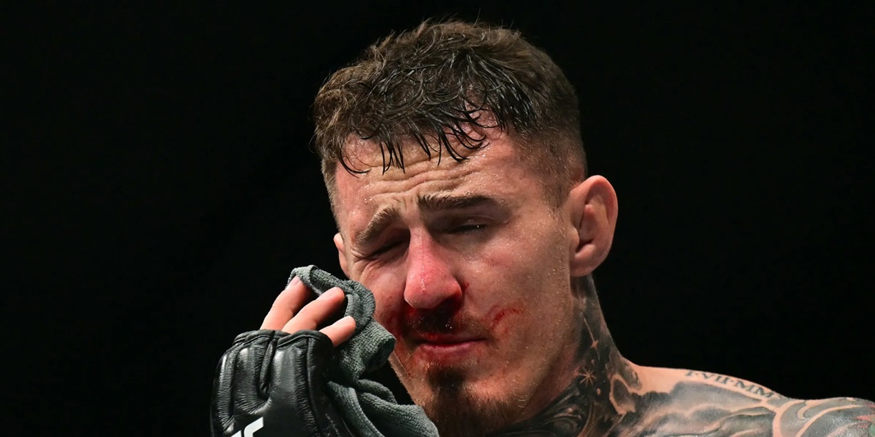 Отец Аспиналла: Том до сих пор ничего не видит одним глазом